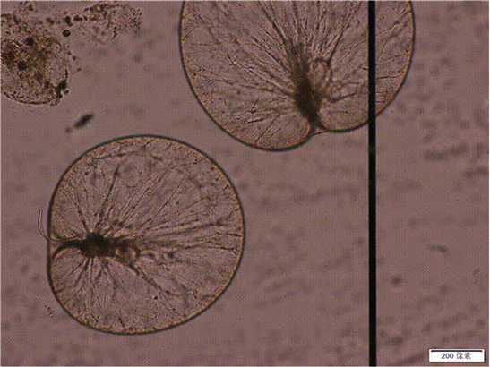 在光学显微镜下,"蓝眼泪"现出原形——原来是你,夜光藻.